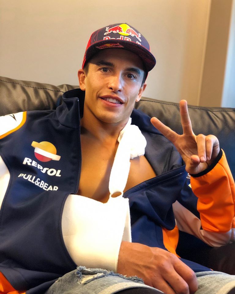 MotoGP: Operasi Lancar, Marc Marquez Siap Balapan Pekan Ini?